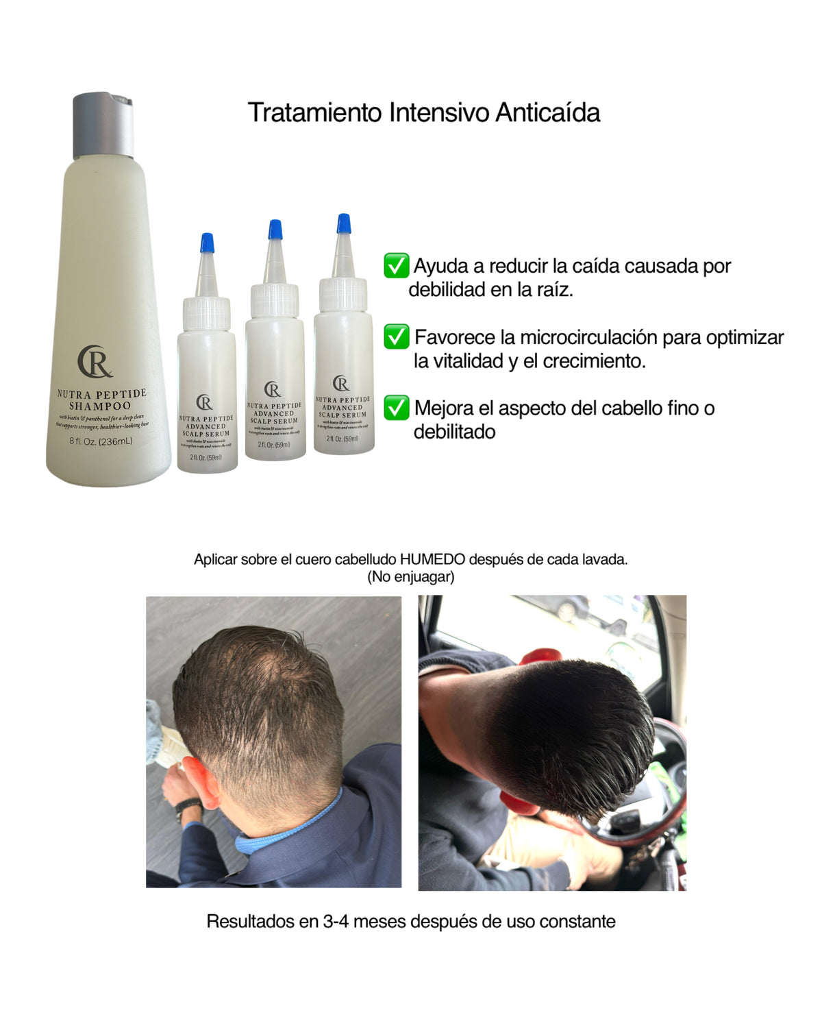 Dúo anticaida nutra peptide para hombre kit de 4